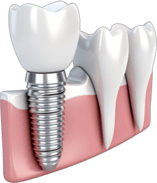 Top orthodontist for braces in Guntur Root canal expert doctor in Guntur