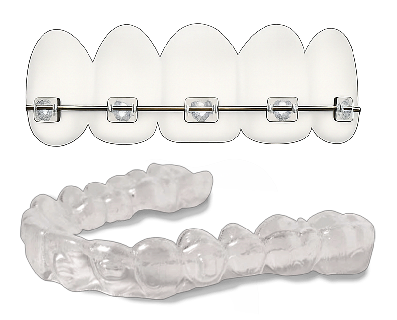 Best dentist in guntur Best dentist clinic in guntur Root canal treatment in guntur Dental implant specialist Guntur Teeth removal treatment in guntur