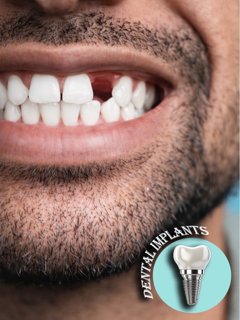 Best dentist in guntur Best dentist clinic in guntur Root canal treatment in guntur Dental implant specialist Guntur Teeth removal treatment in guntur