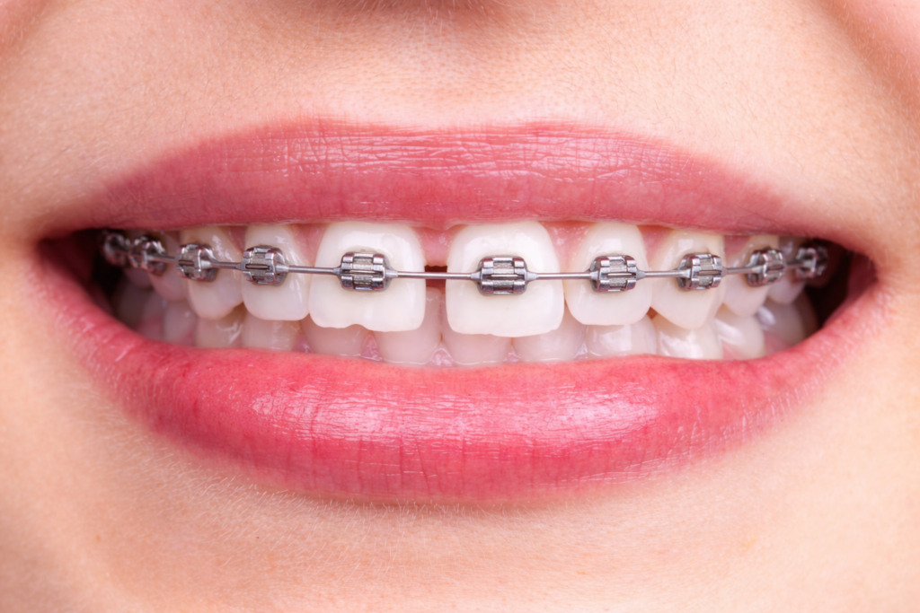 Best dentist in guntur Best dentist clinic in guntur Root canal treatment in guntur Dental implant specialist Guntur